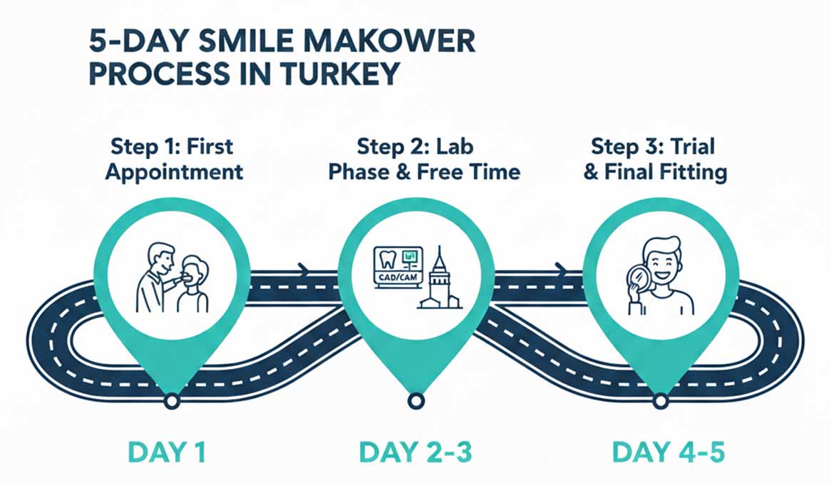 A roadmap infographic showing the 5-day treatment process for laminate veneers in Turkey, from the first appointment (Day 1) to the final fitting (Day 4-5)