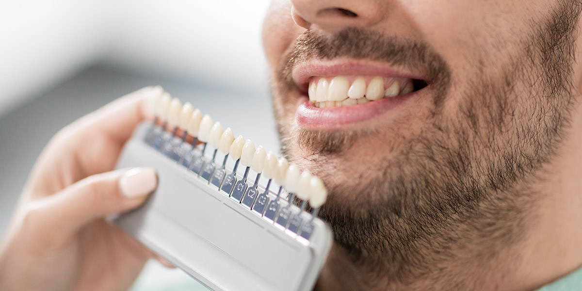 Dental Colour Decision