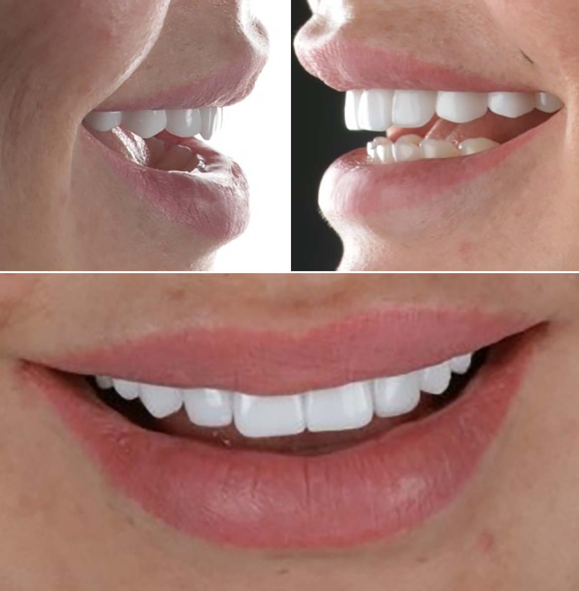 Hollywood Smile of Elena