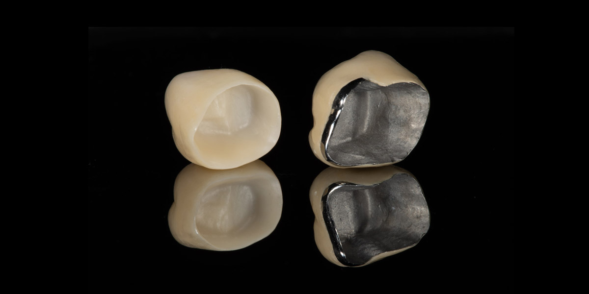 Metal And Zirconium Porcelain Crowns