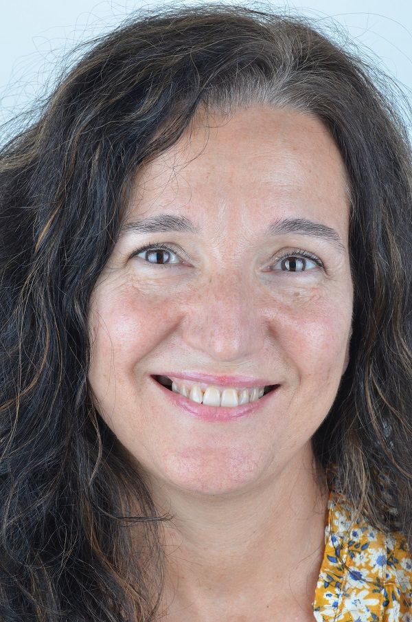 Isabella Missing Tooth Dental Implants Metal Porcelain Crowns