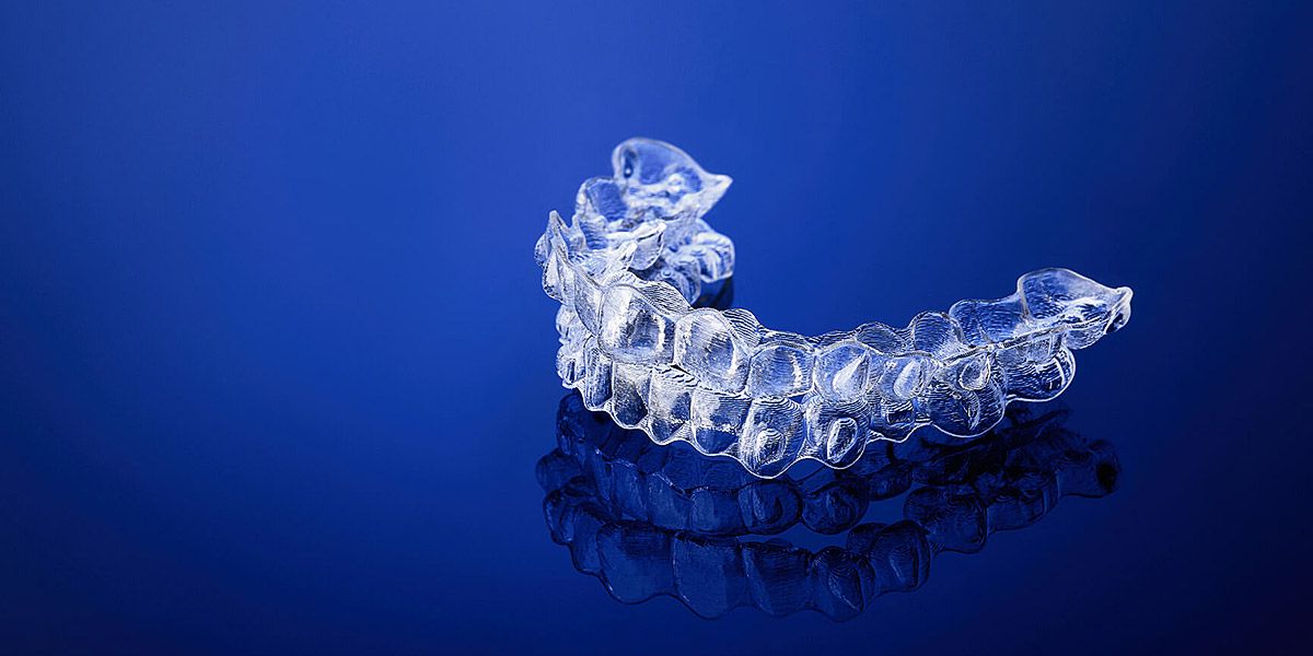Aligners Control and Clean