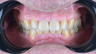 Brian Dental Implants Smile sp