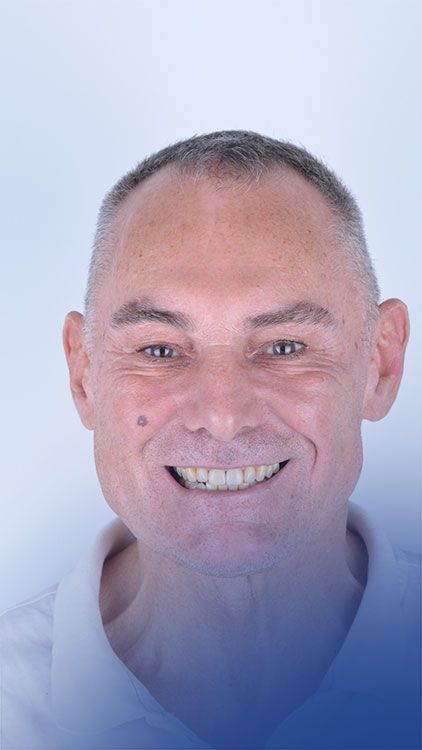 Brian Dental Implants Turkey Experience