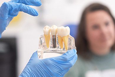 Dental Implants Loading