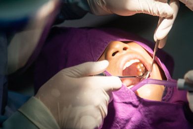 Surgical Tooth Extraction Surgical Tooth Extraction