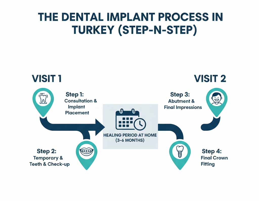 An infographic illustrating the step-by-step dental implant process in Turkey, showing two visits separated by a 3-6 month healing period at home, covering consultation, implant placement, temporary teeth, abutment, impressions, and final crown fitting.