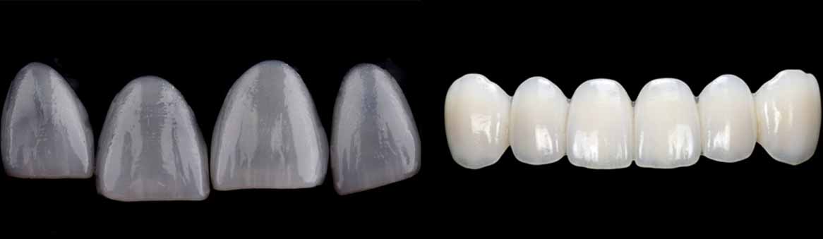 A close-up studio shot of several translucent laminate veneers, showing their high-quality material and shape, used for smile makeovers in Turkey