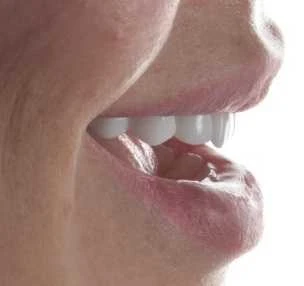 Elena Smilemakeover Turkey Teeth